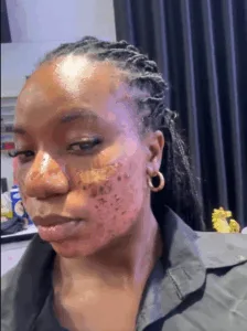 @iamthelma_